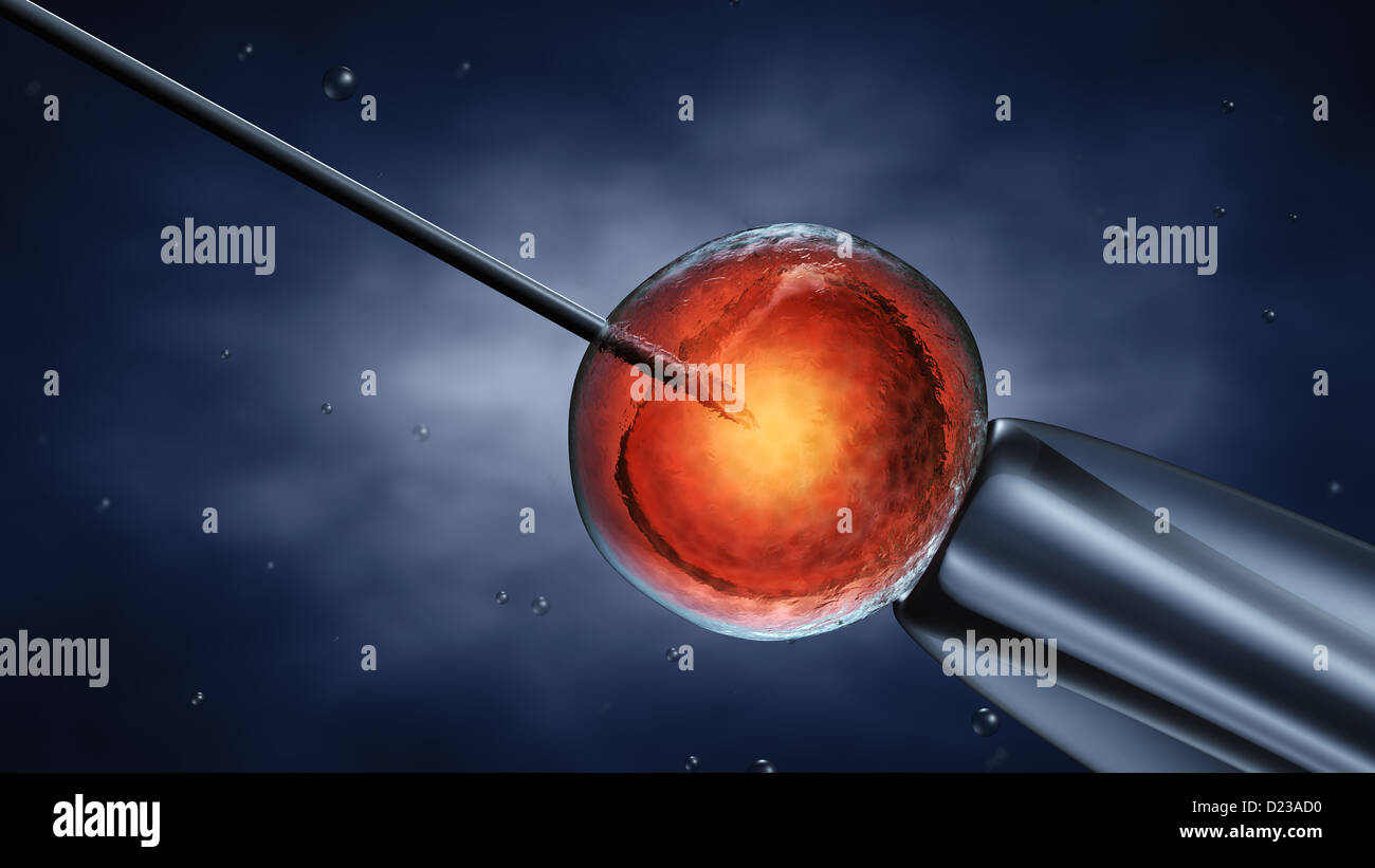 Iniezione di sperma intracitoplasmica , lo sperma iniettato in un oocita , illustrazione dettagliata Foto Stock