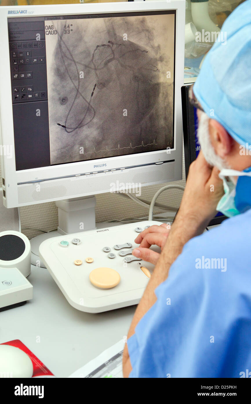 Angiografia coronarica Foto Stock