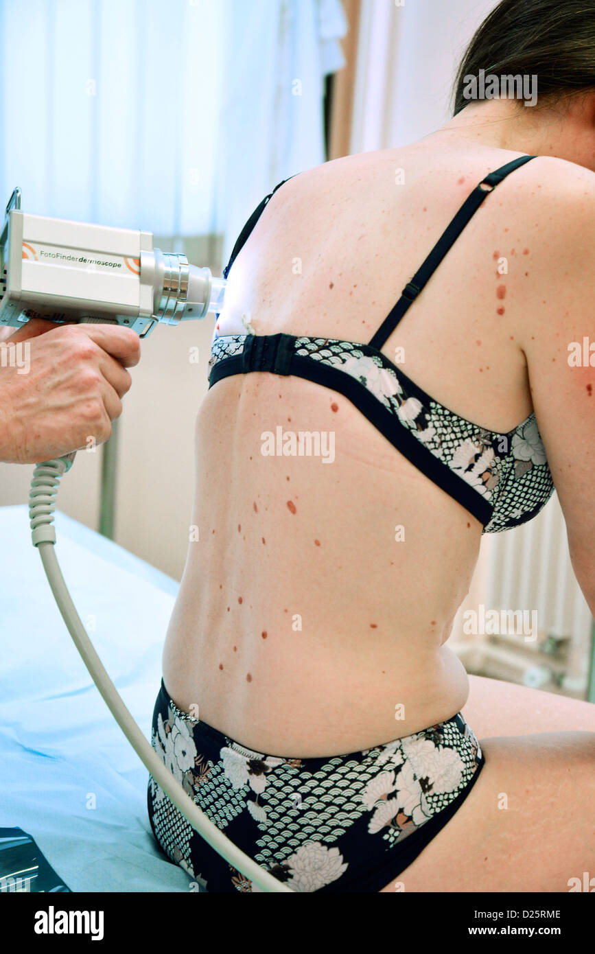 Dermatologia la sintomatologia, Donna Foto Stock