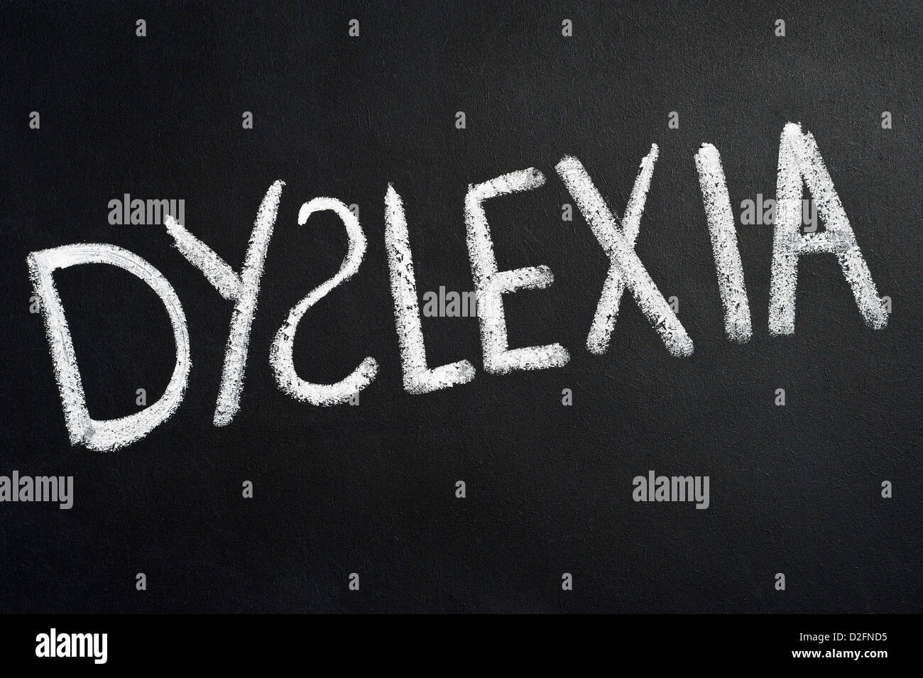 La parola DYSLEXIA scritta su una lavagna con gesso bianco con la S al contrario Foto Stock