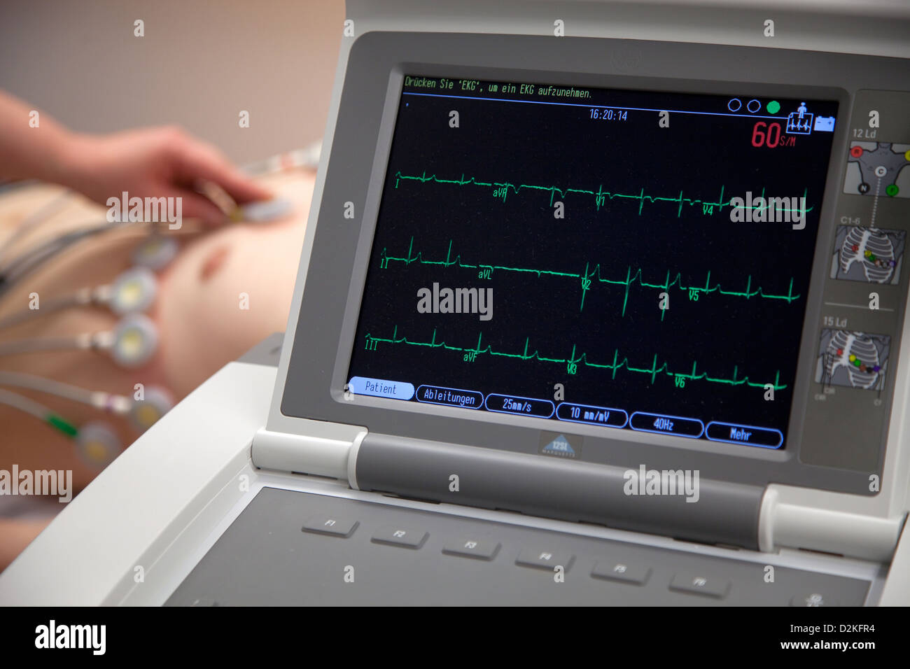 Essen, Germania, la frequenza cardiaca curva di un paziente con ECG a riposo Foto Stock