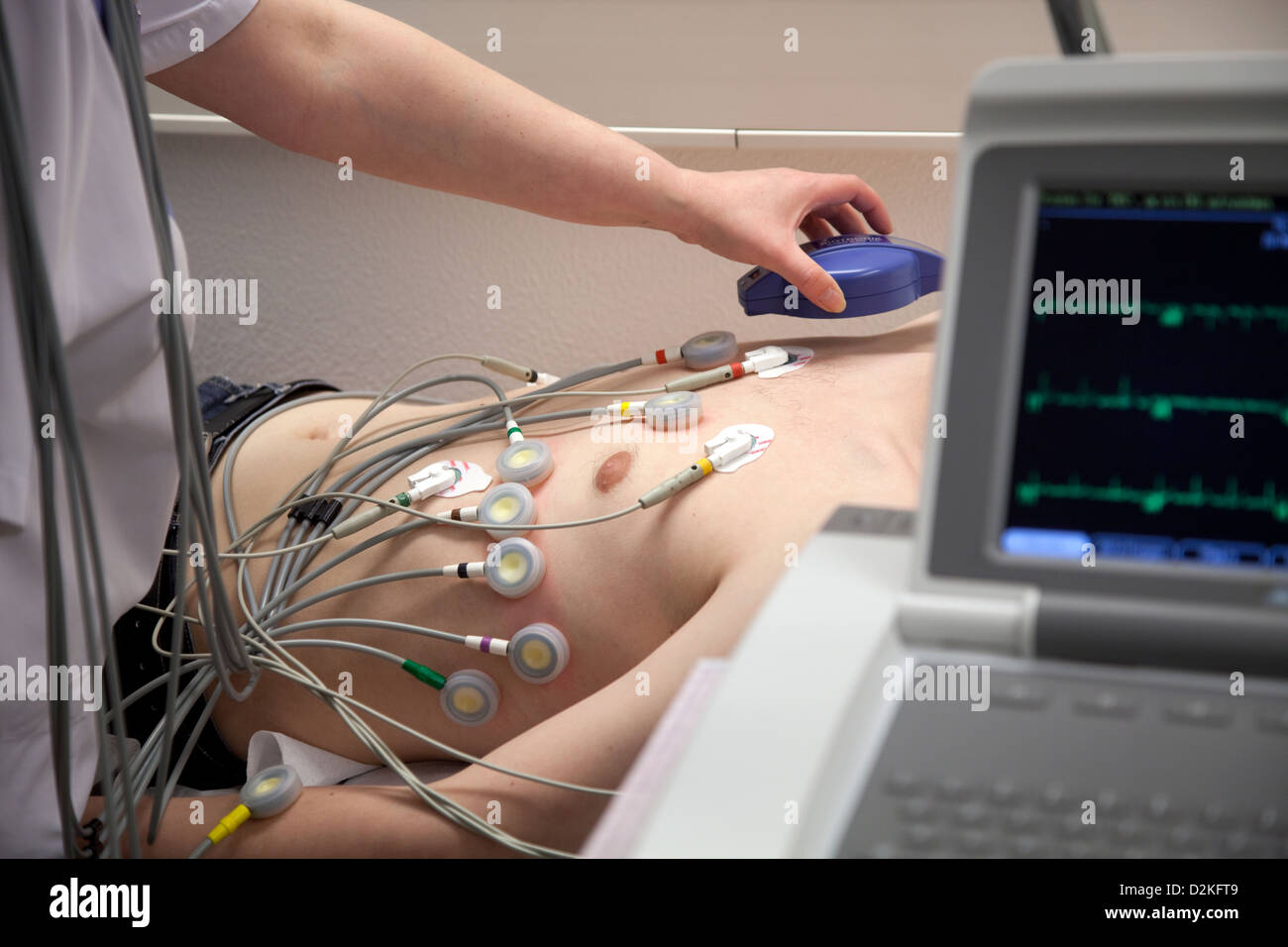 Essen, Germania, ECG a riposo con controllo dello stimolatore cardiaco in un paziente Foto Stock