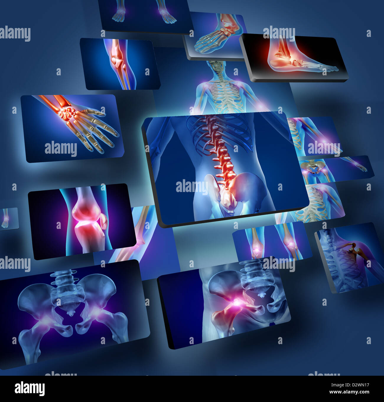 Articolazioni umane concetto con lo scheletro anatomia del corpo con un gruppo di pannelli di articolazioni doloranti incandescente come il dolore e la lesione o malattia artrite simbolo per cure sanitarie e mediche sintomi. Foto Stock