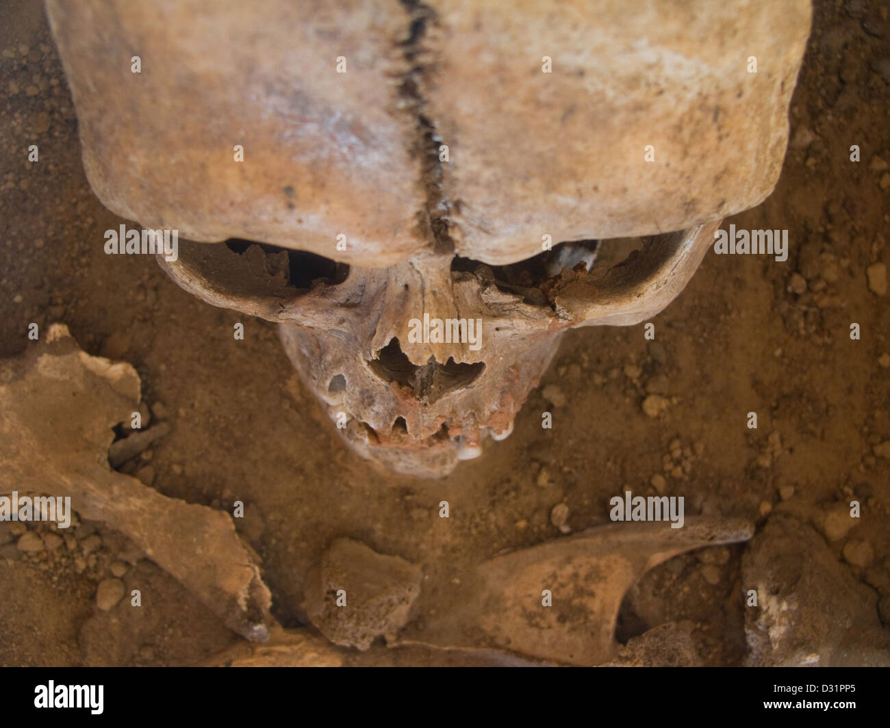 Cranio umano visto da sopra con il terreno in background Foto Stock