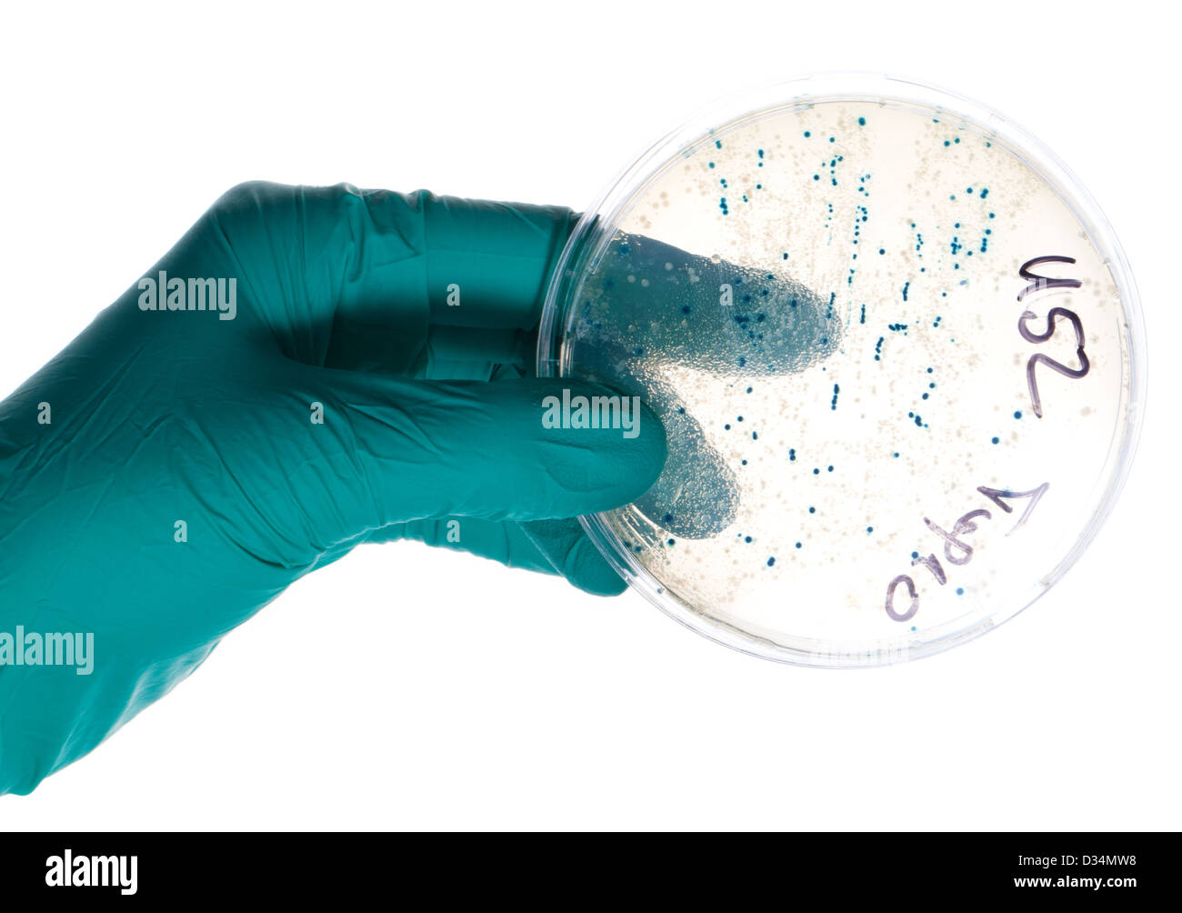 Mano in nitrile guanto contiene piastra Petri con colonie batteriche Foto Stock