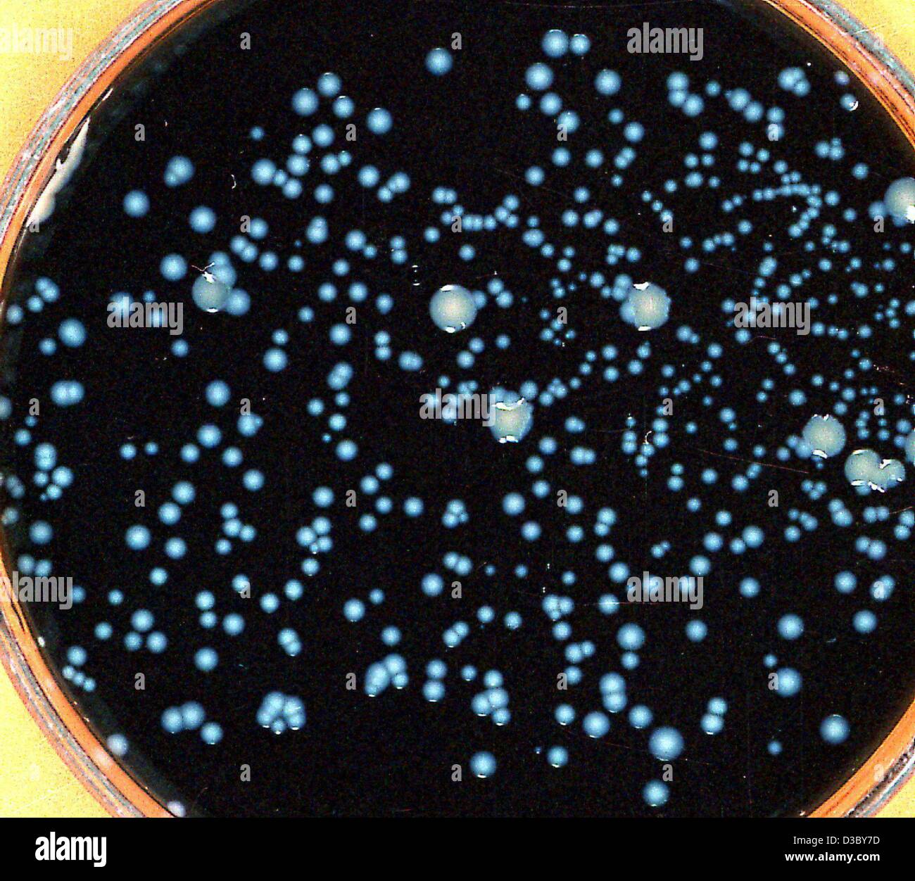 (Dpa file) - Un filer non datata rilasciato dall'Università tecnica di Dresda, in Germania, mostra una colonia del batterio Legionella pneumophila, che può provocare il cosiddetto morbo del legionario, su un supporto di carbone. La diffusione di batteri soprattutto nella scarsa manutenzione dei tubi dell'acqua, acqua calda s Foto Stock