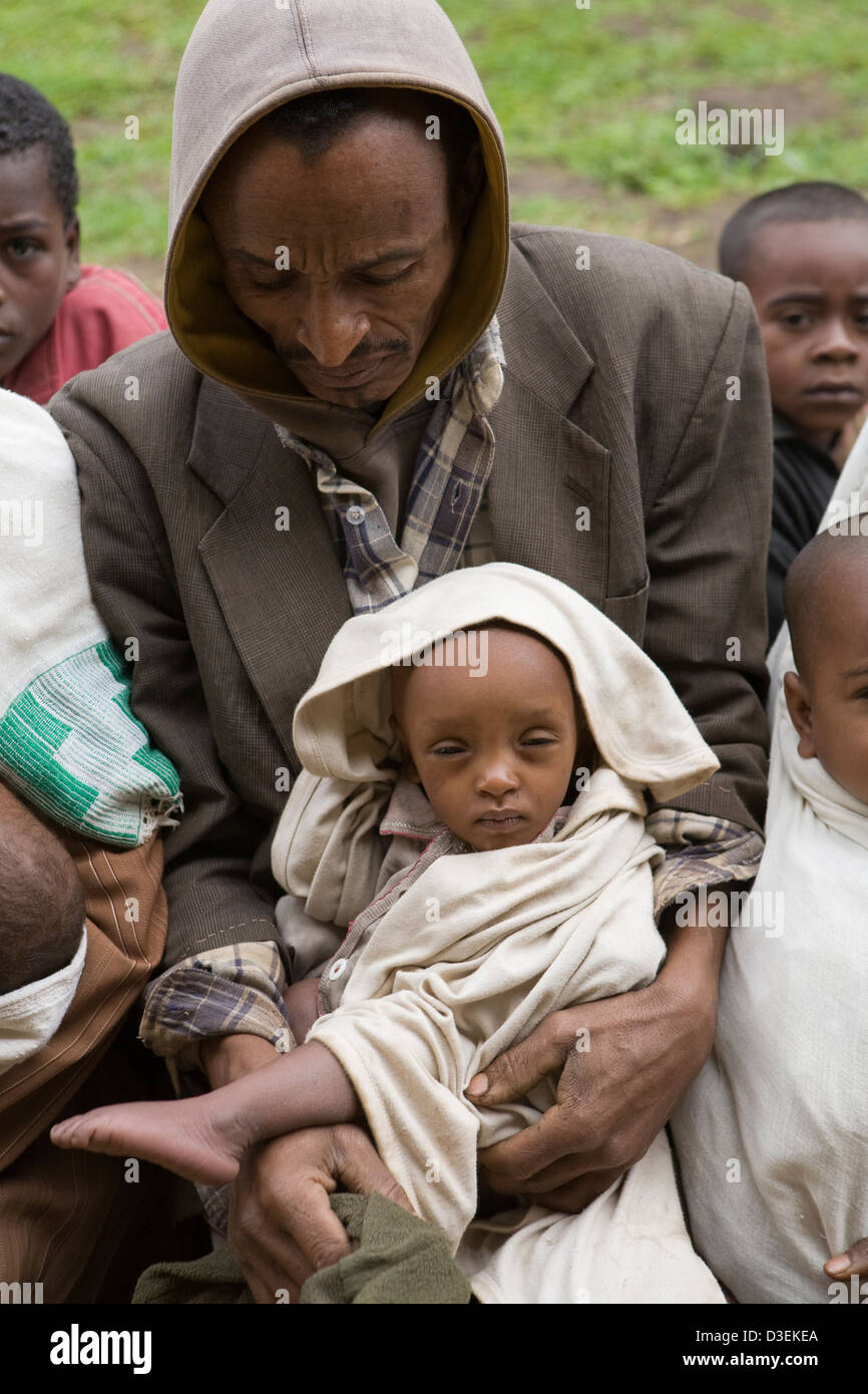 BITENA CENTRO SALUTE, WOLAYITA, Etiopia, 20AGOSTO 2008: Dampday Dado, ha portato la sua 14 mesi figlia malnutriti Foto Stock