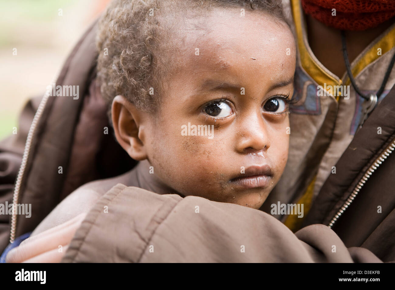 BITENA CENTRO SALUTE, WOLAYITA, Etiopia, 20AGOSTO 2008: Masaret Linta, 17, è venuto per la OTP con il suo bambino di 4 anni sorella Foto Stock