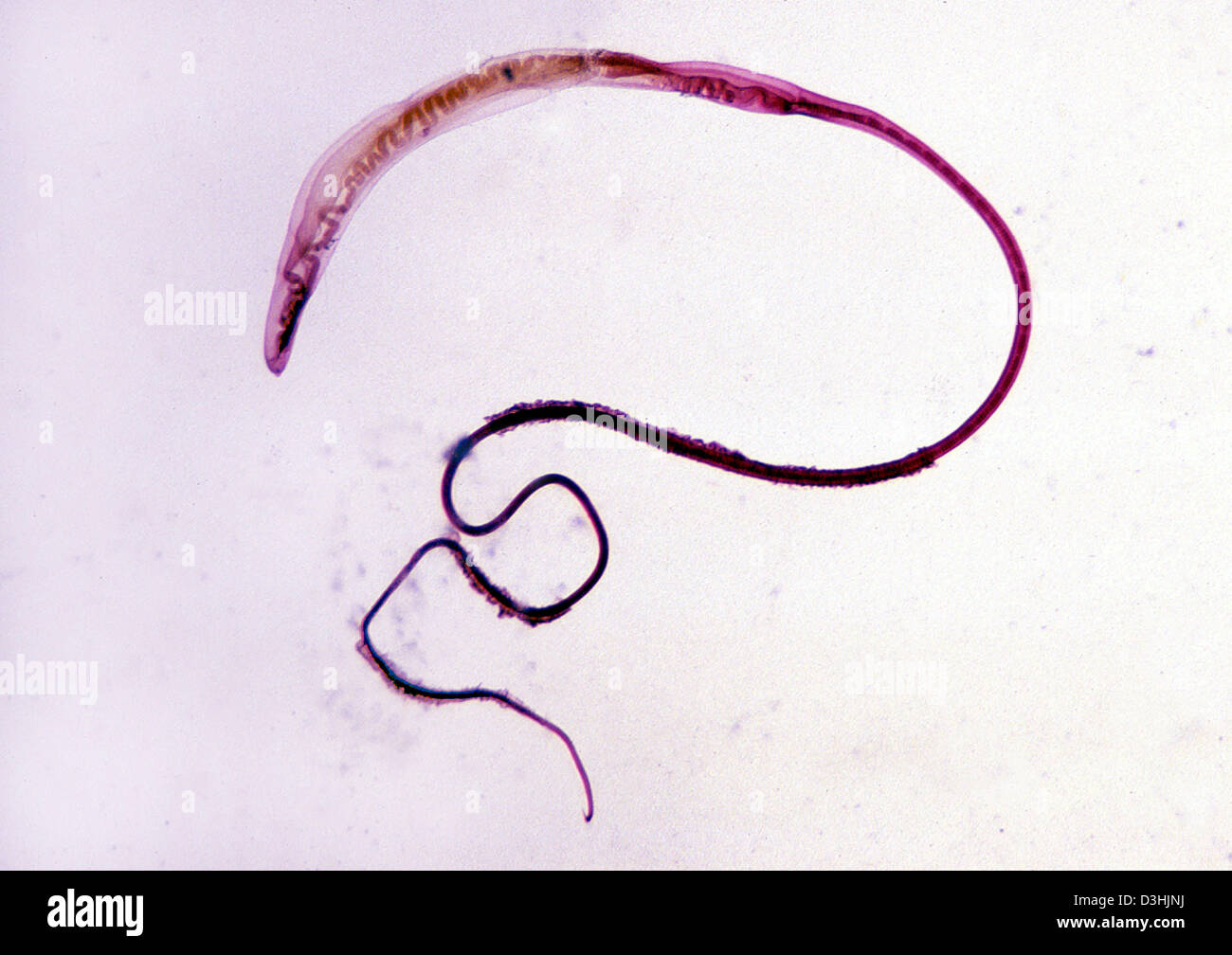 TRICHOCEPHALUS Foto Stock