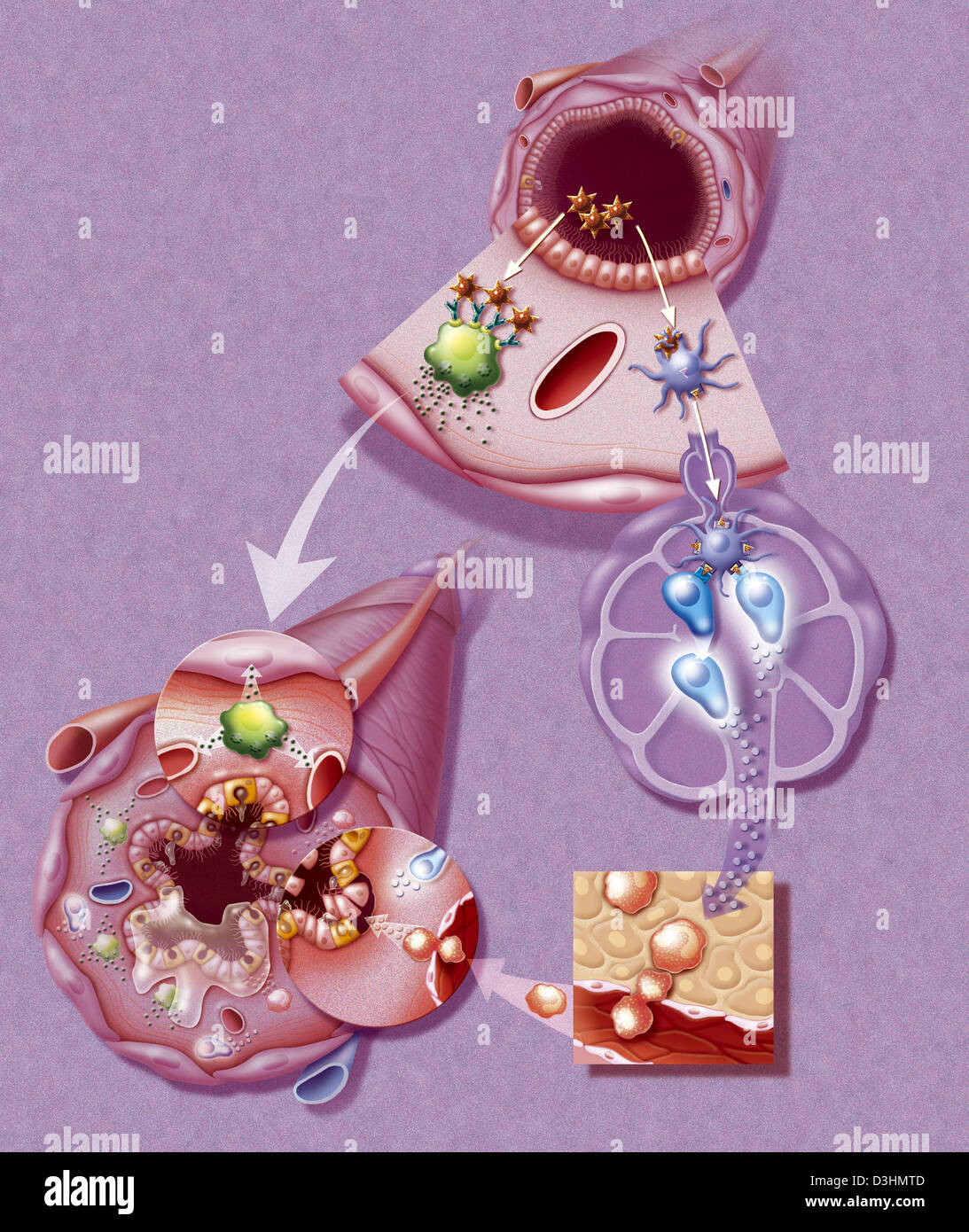 ASMA, DISEGNO Foto Stock