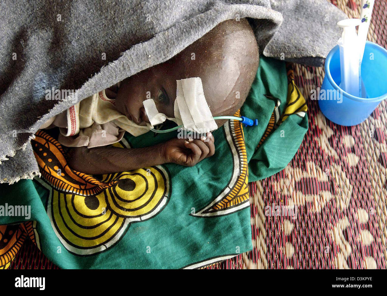 (Dpa) - Un bambino che soffre di malnutrizione grave risiede nella alimentazione terapeutica centro dell'organizzazione umanitaria "edecins sans frontieres" (Medici senza frontiere) a Maradi, in Niger, 15 agosto 2005. La fame è un problema perenne in Niger e Mali, Mauritania e Burkina Faso ed è stata aggravata da una invasione di locuste lo scorso anno seguita da siccità. L'U.N. dice milioni Foto Stock