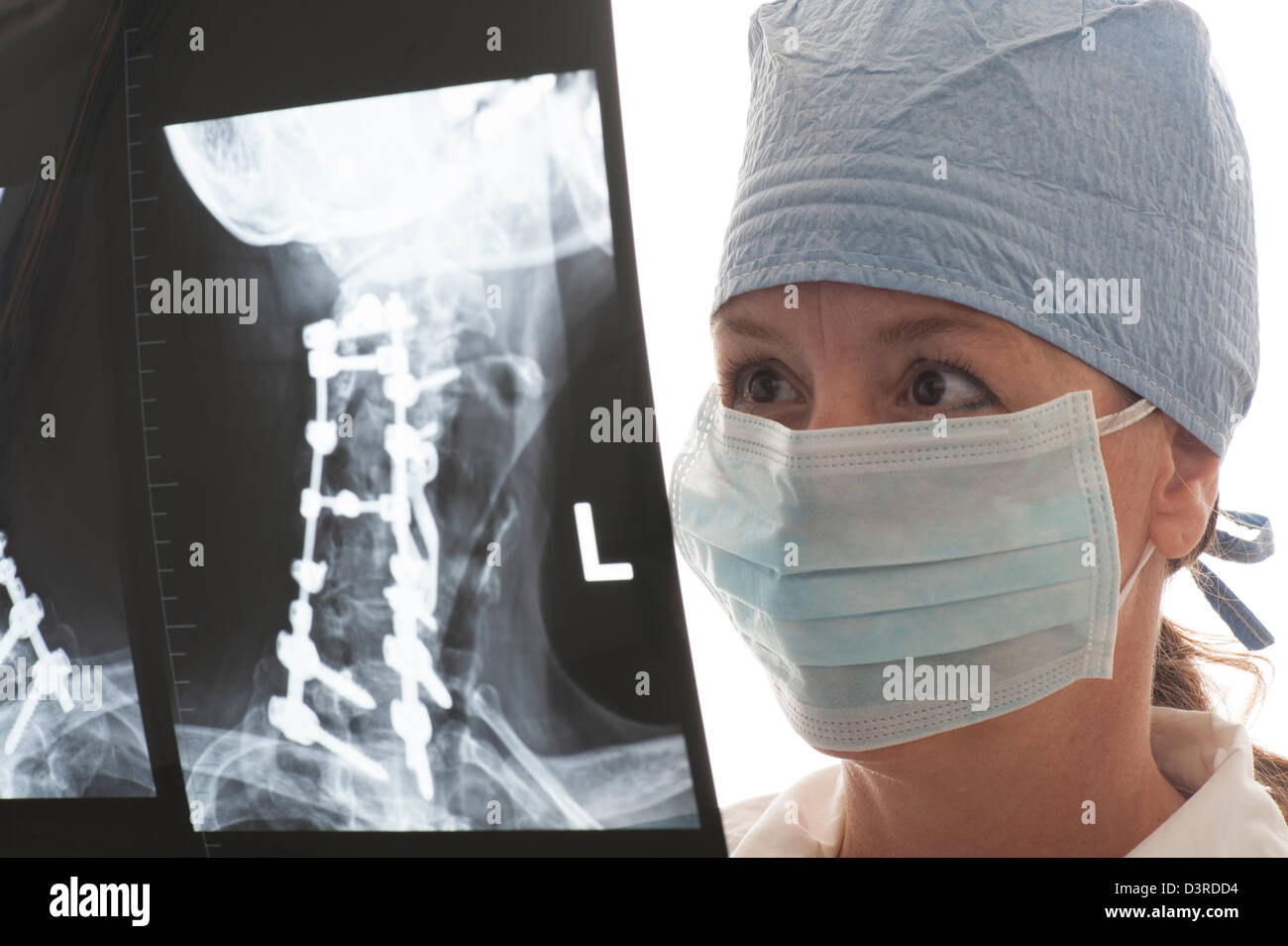 Donna dottore guardando vertebrale superiore X-ray Foto Stock