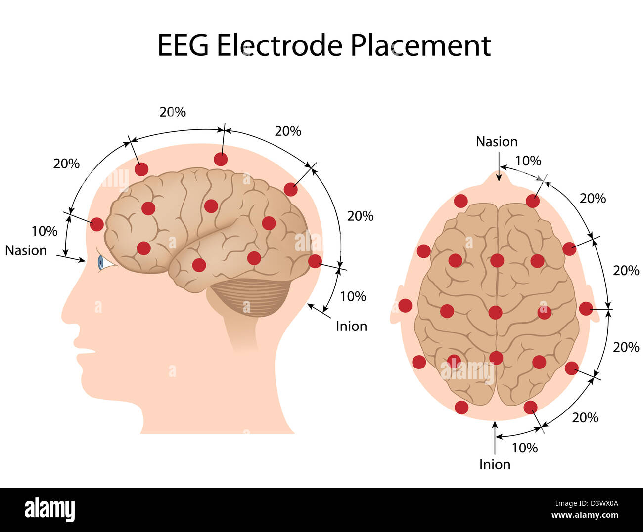 EEG il posizionamento degli elettrodi Foto Stock