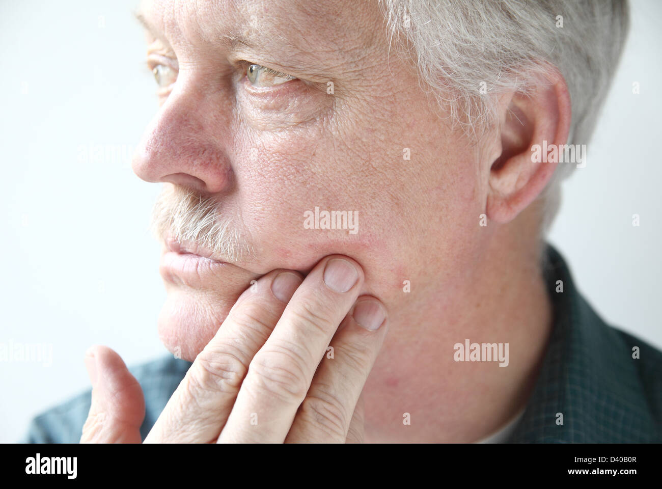 Uomo anziano con un rosso, eritema pruriginoso sulla sua guancia Foto Stock