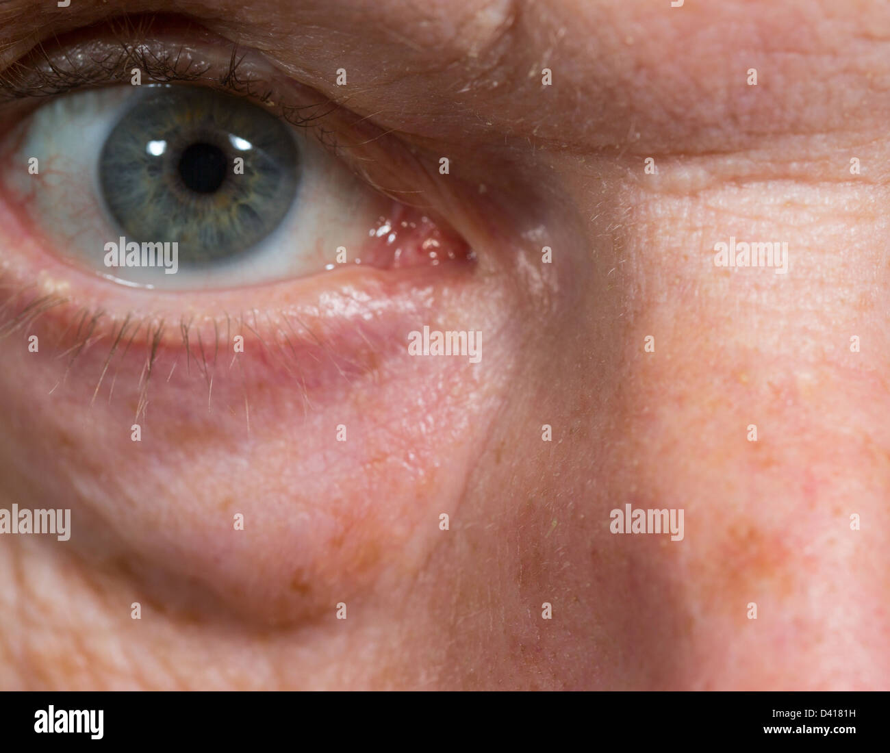 Macro close up di occhio di un anziano uomo caucasico con rughe e borse sotto gli occhi Foto Stock