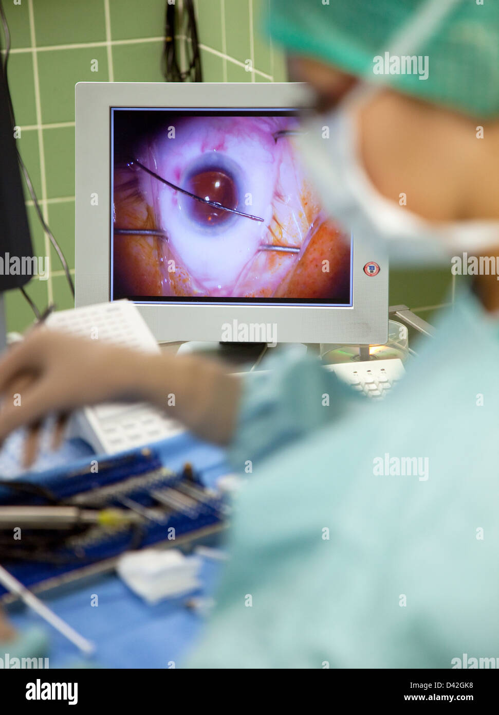 Germania, ospedale, chirurgia della cataratta Foto Stock