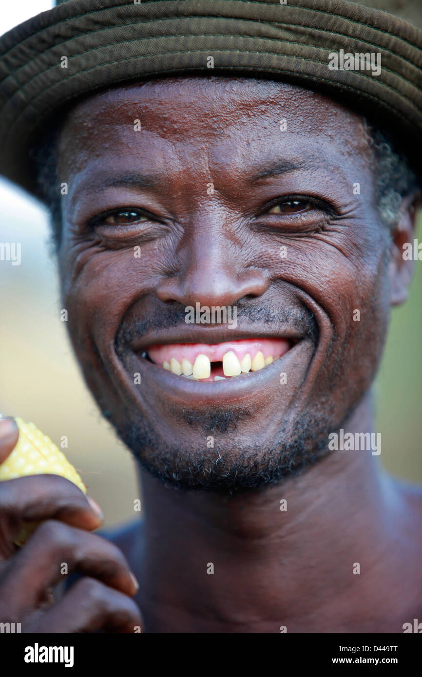 Il Sorriso Senza Un Dente Foto Stock Alamy