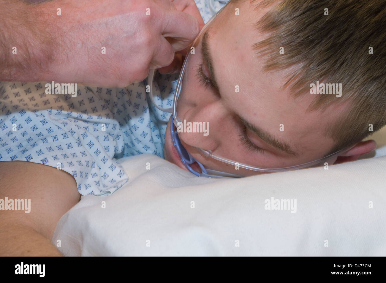 Un uomo che subisce una procedura endoscopica per la rimozione dei fanghi dal suo dotto biliare. Foto Stock