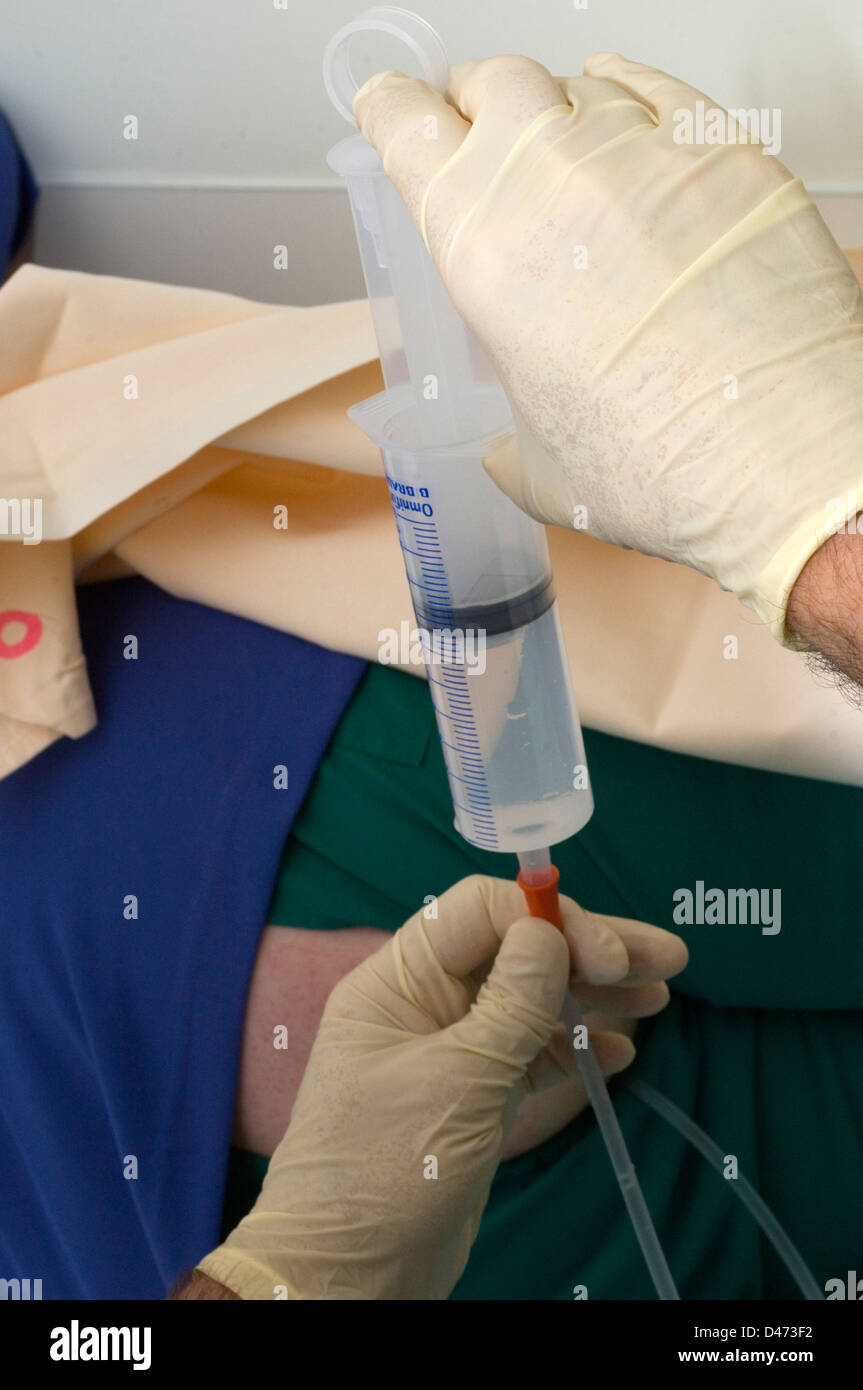 Siringa utilizzata per iniezioni endovenose. Foto Stock