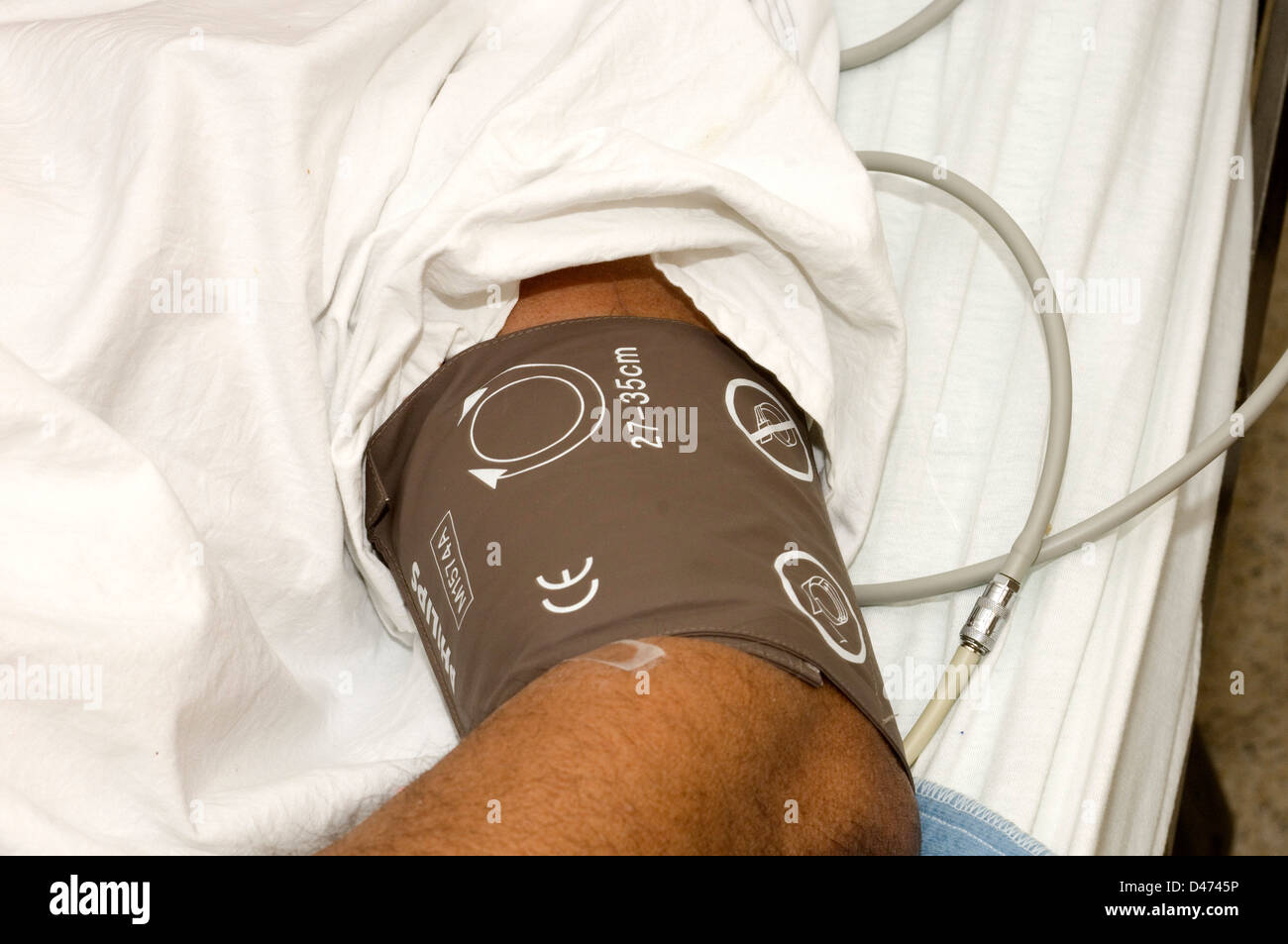Una fascia per il braccio del dispositivo di monitoraggio per controllare la pressione sanguigna di un paziente. Foto Stock