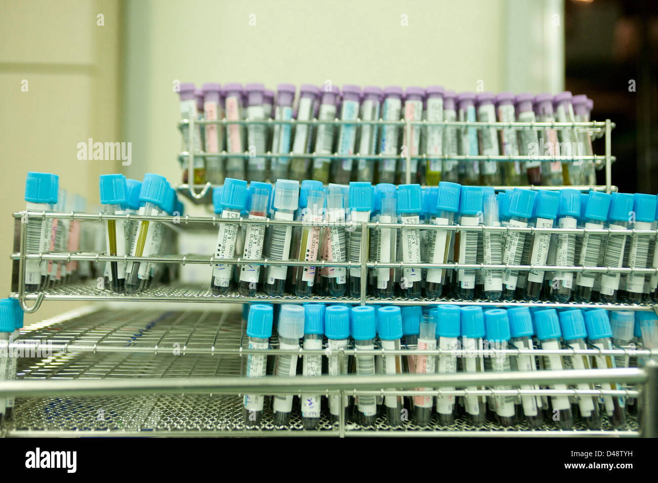 I campioni di sangue sono separati in tipi dopo essere stato testato e analizzato. Foto Stock
