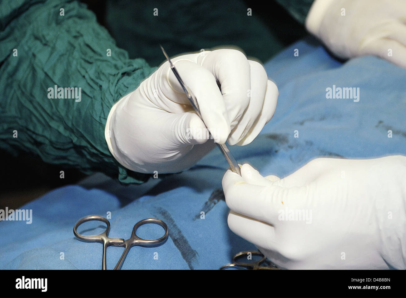 I chirurghi assistant di consegnare un bisturi per il chirurgo, così che si può fare una incisione iniziale Foto Stock