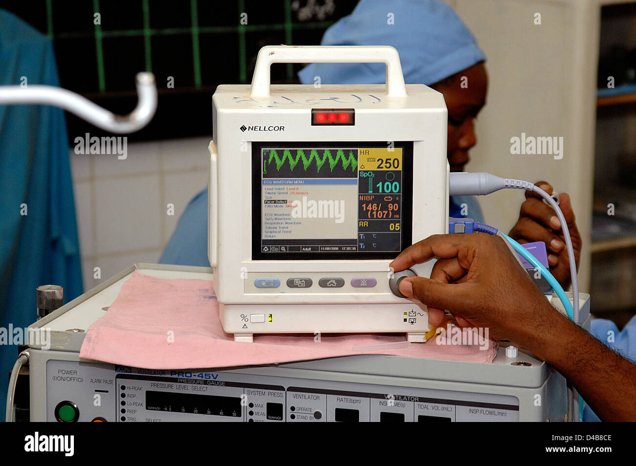 Un elettrocardiogramma graphic prodotto elettrocardiografo; a loro volta i record di attività elettrica del cuore nel tempo diverse ondate Foto Stock