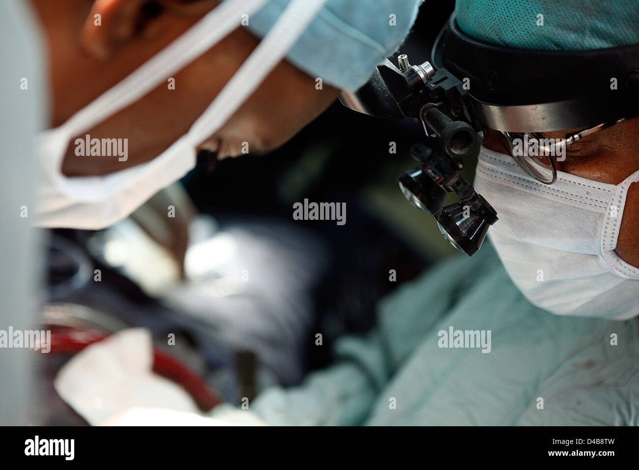 Il chirurgo di piombo indossa le lenti di ingrandimento su occhiali lenti di ingrandimento di dare chirurgo molto più chiara visualizzazione area operativa Foto Stock