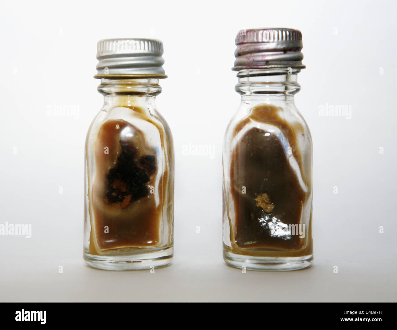 Culture Mycetoma presi in esame determinare se i batteri o funghi presenti in numeri multipli possono essere testati contro diversi Foto Stock