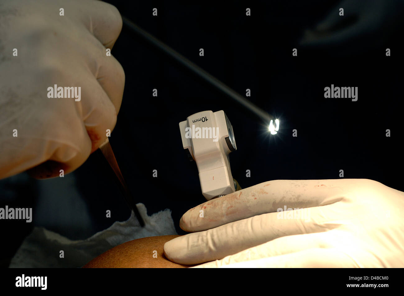 Il laparoscopio contiene fibre ottiche, una sorgente di luce e appositamente progettati strumenti chirurgici. Foto Stock