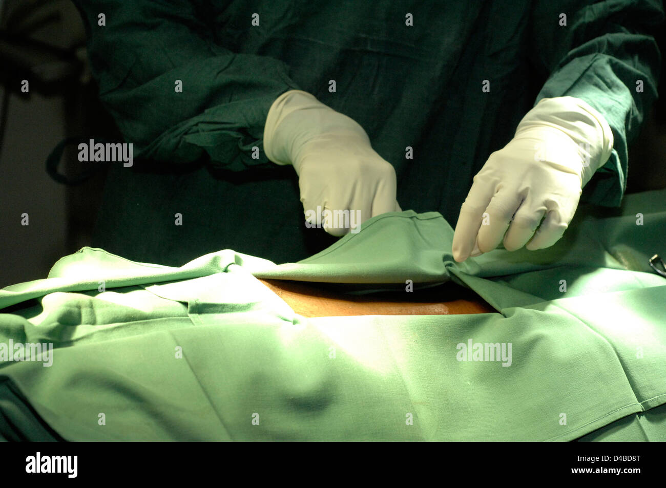 Chirurgo garantendo oscuranti sono fissati prima di iniziare un intervento chirurgico Foto Stock