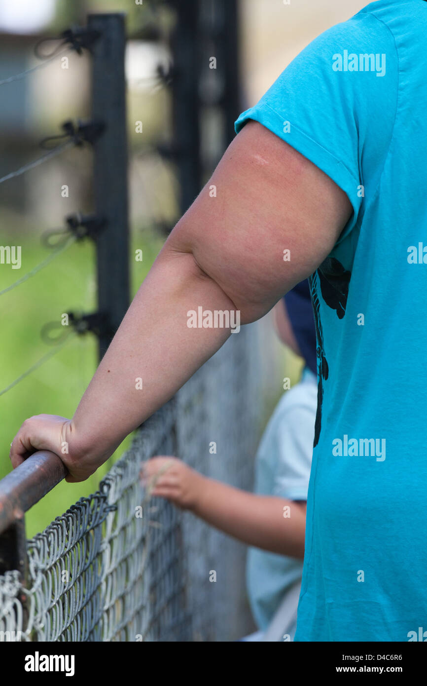 Una donna e il braccio sinistro del bambino, SUPPORTRED dalla linea di recinzione. Illustrare obesità estrema. Foto Stock