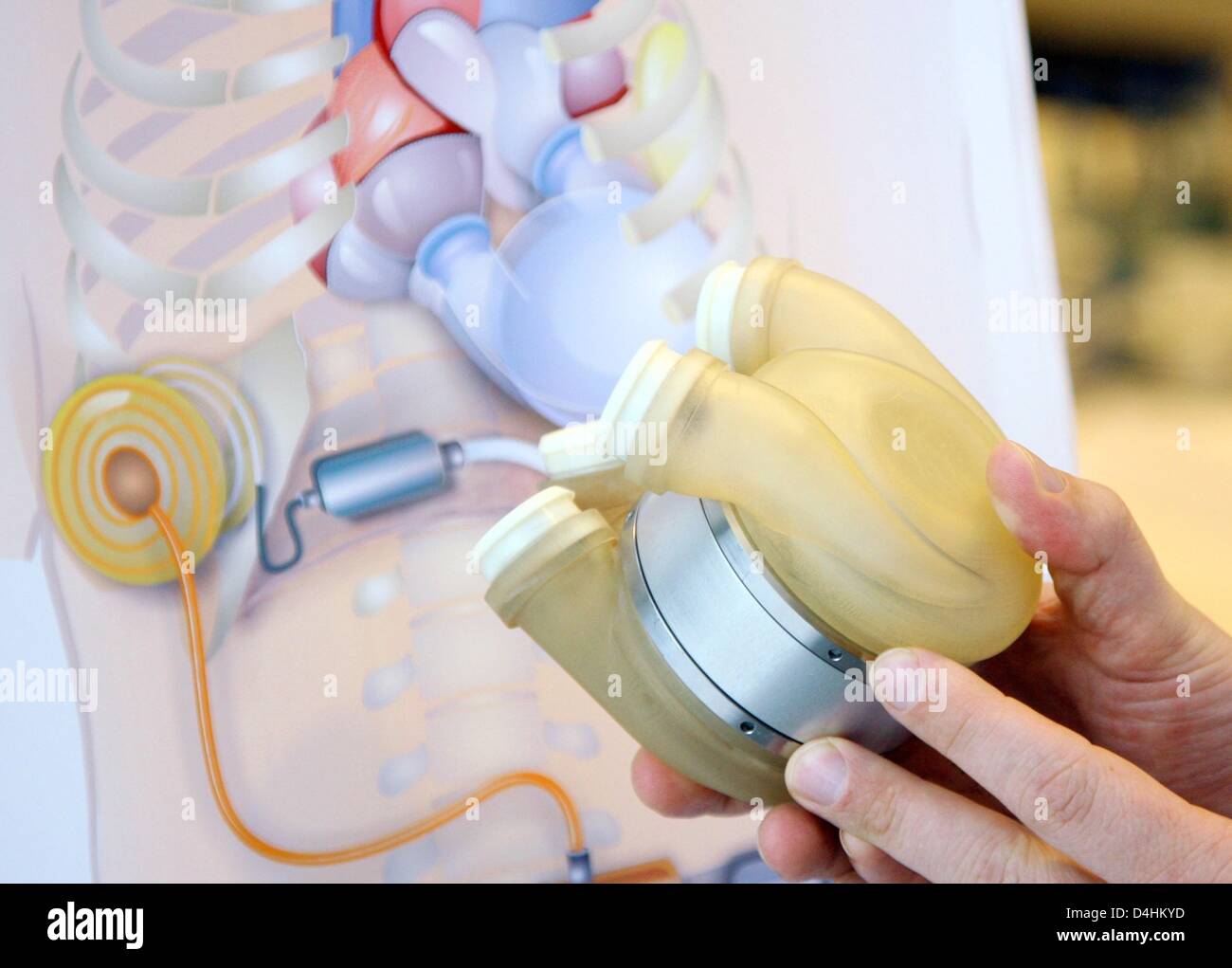 Vista su completamente impiantabile cuore artificiale ReinHeart ?? Il cuore e il diabete nel centro di Bad Oeynhausen, Germania, 23 gennaio 2009. Gli scienziati hanno testato con successo il nuovo cuore artificiale in esperimenti su animali è stato impiantato per un vitello il 21 gennaio e ha lavorato stabile per oltre un ora prima è stato spento. Foto: FRISO GENTSCH Foto Stock