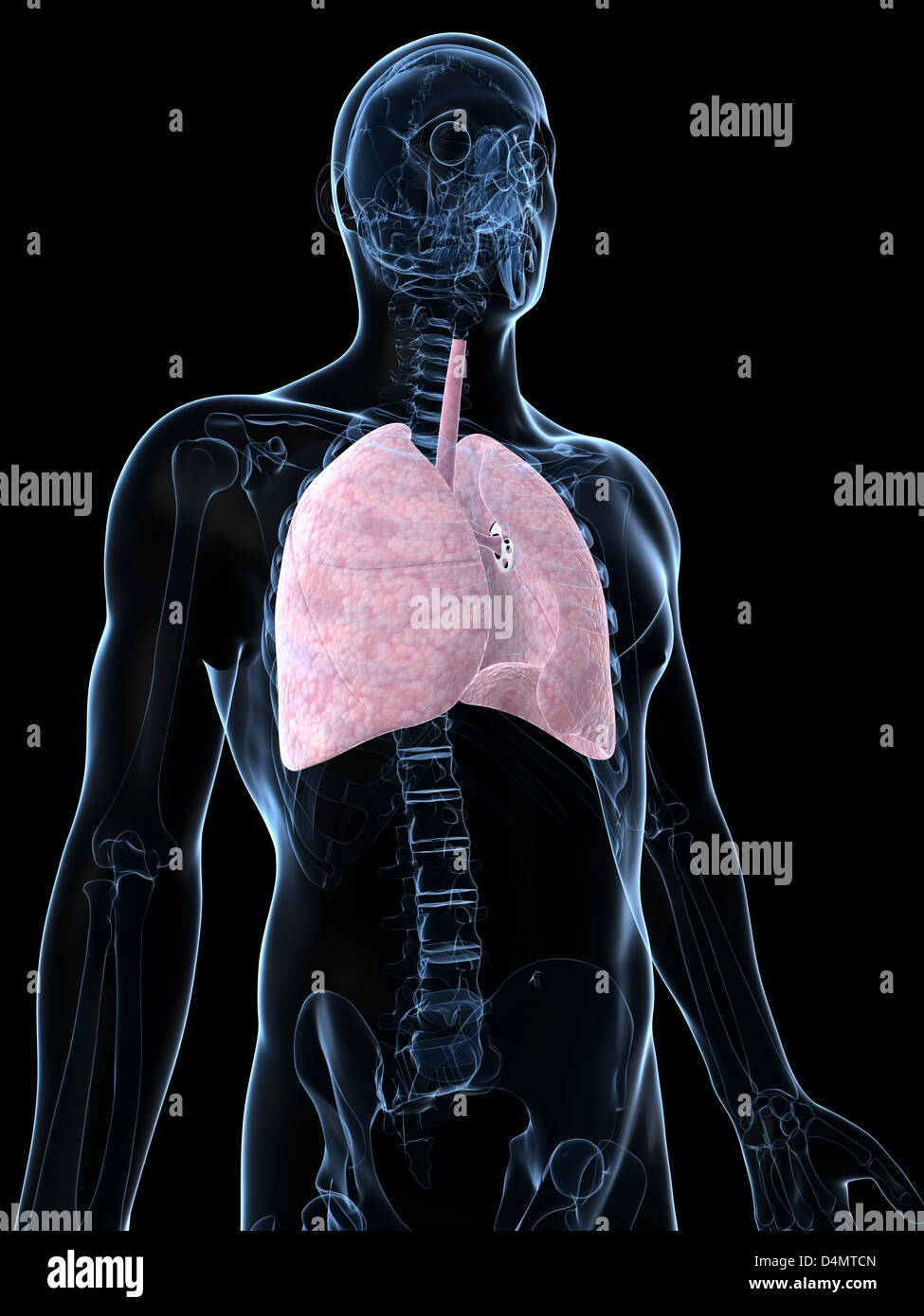 Male´s polmonare Foto Stock