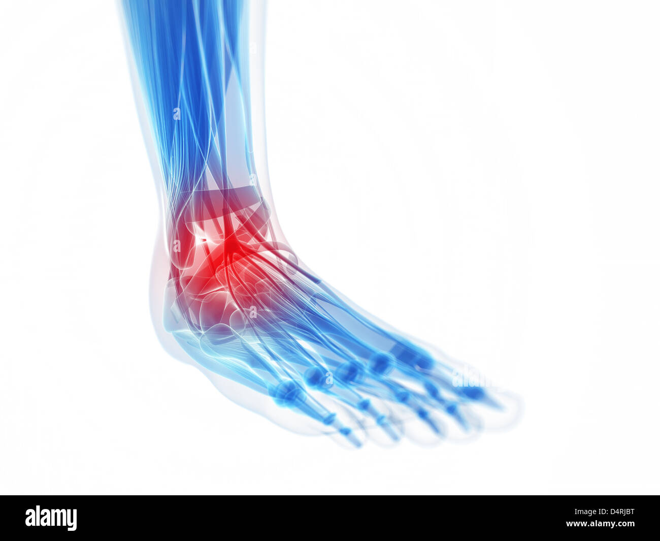 X-ray piede - dolorosa caviglia Foto Stock
