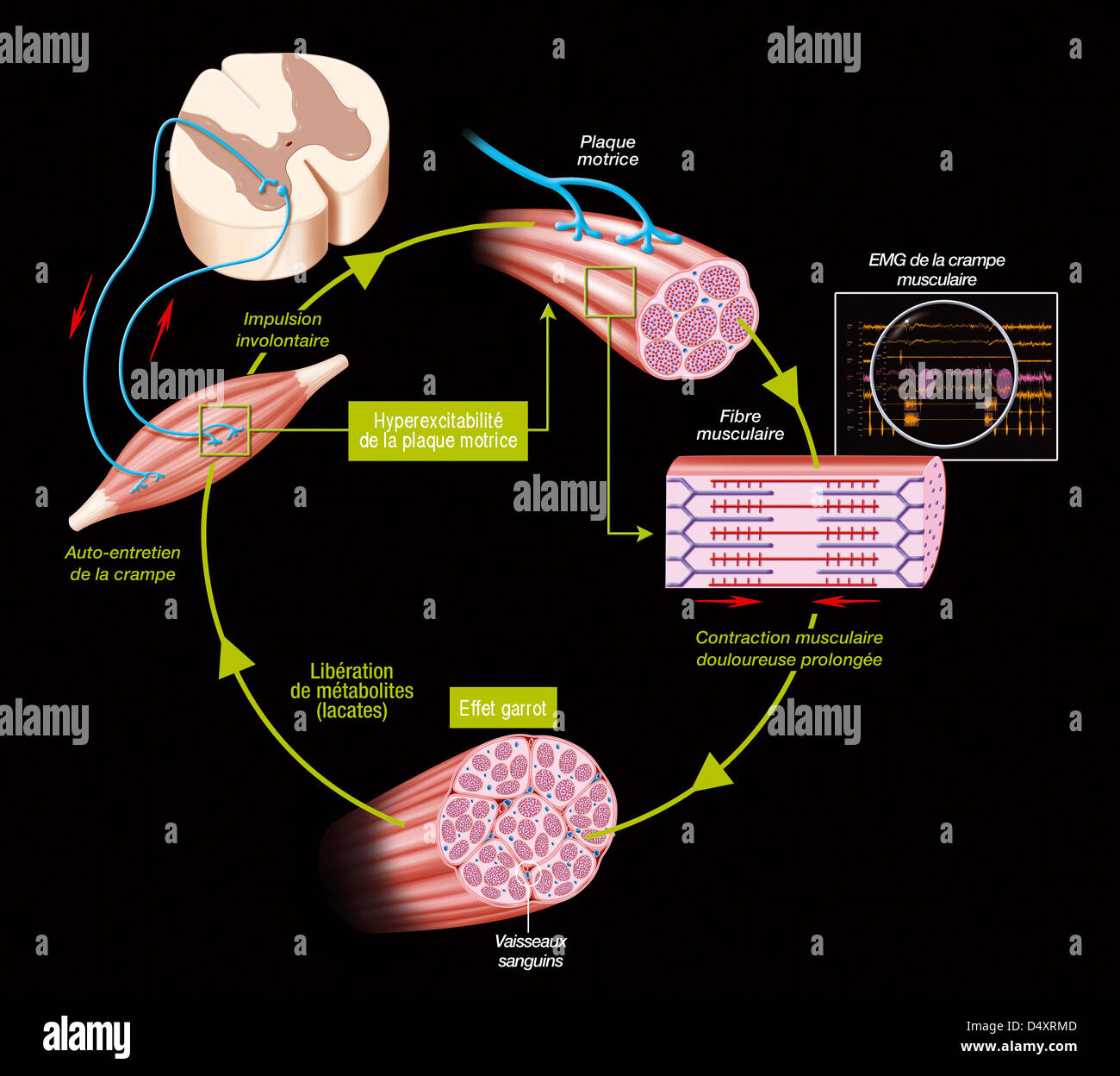 CRAMPO, DISEGNO Foto Stock
