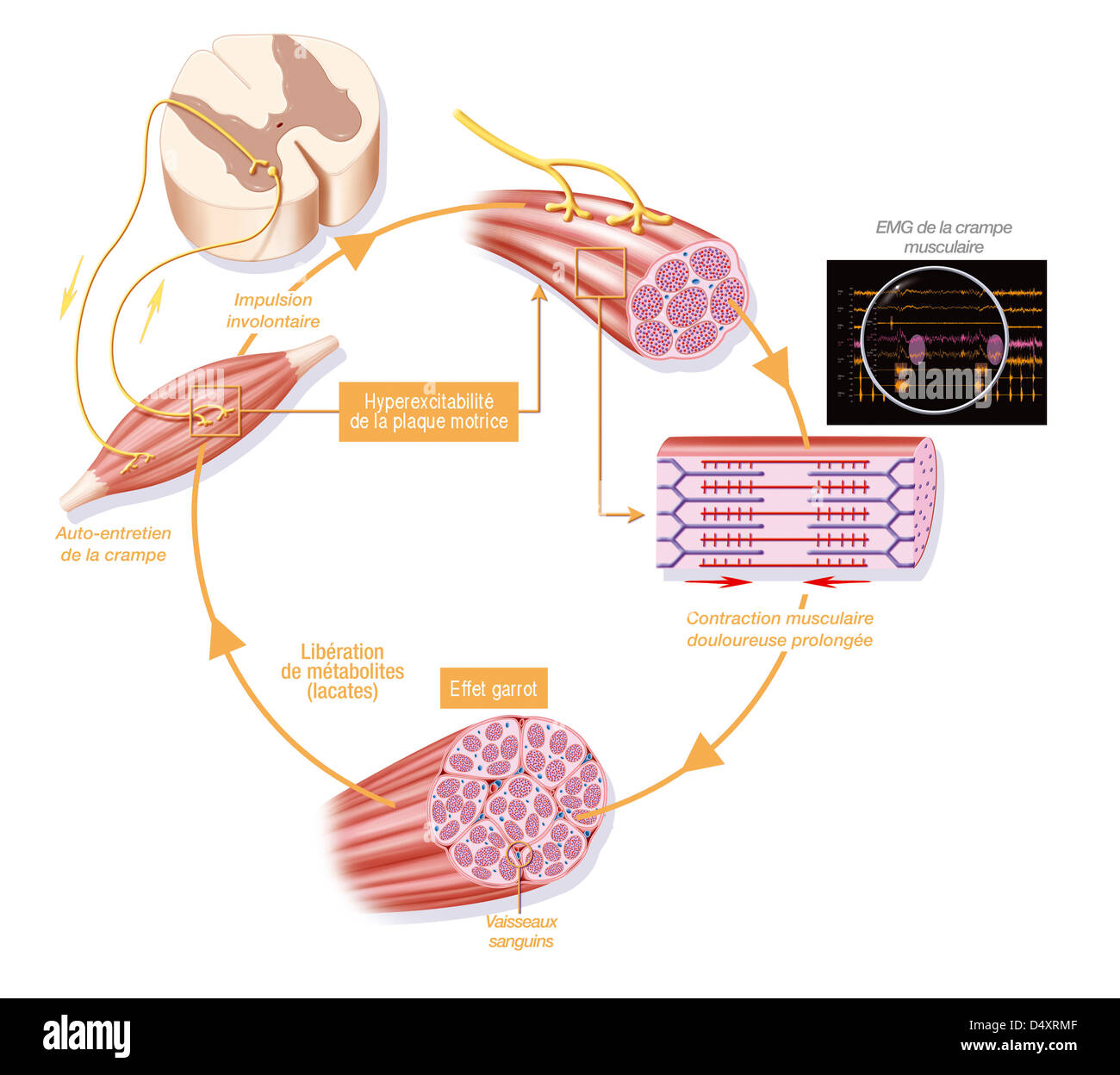 CRAMPO, DISEGNO Foto Stock