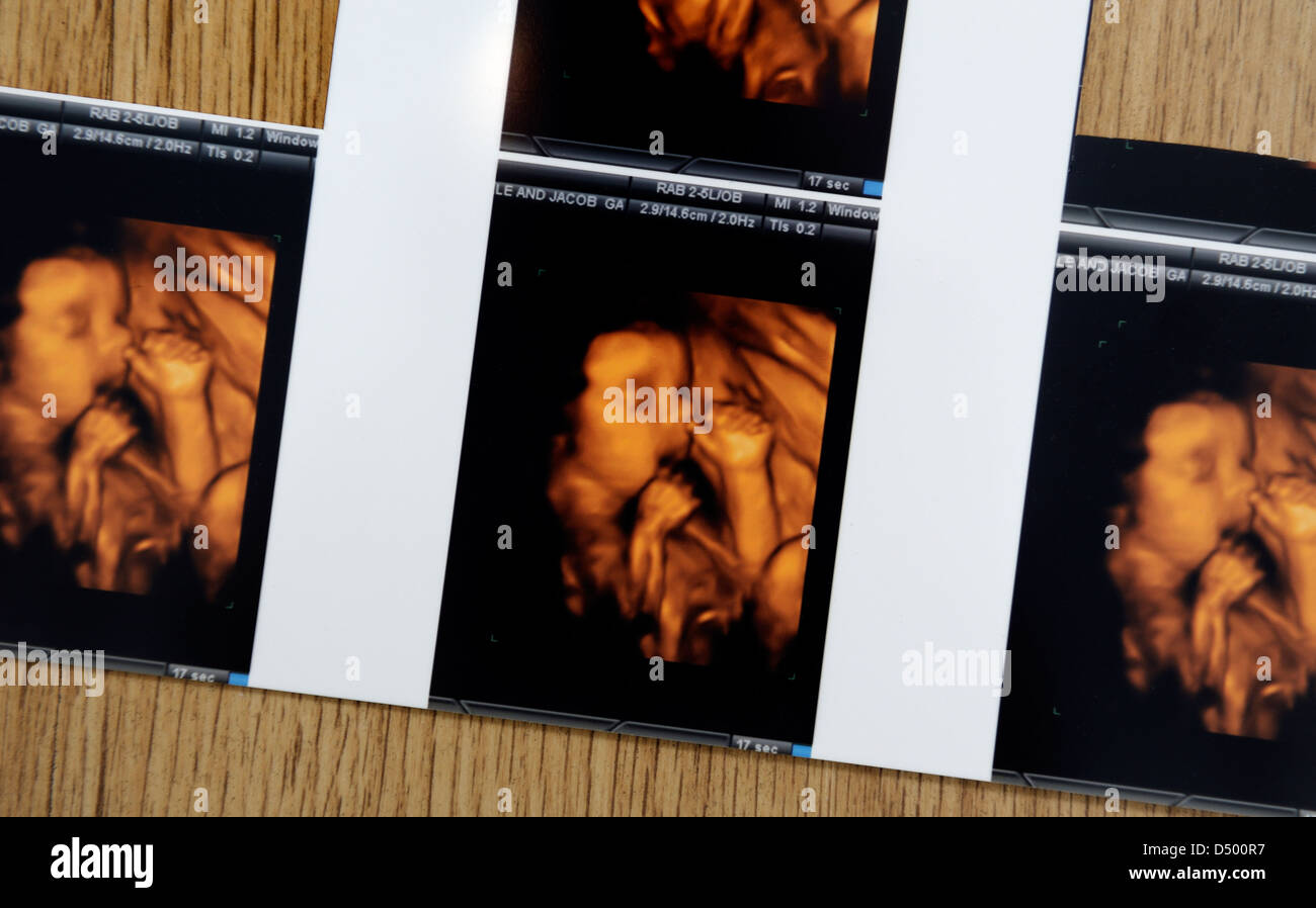 4D bambino scansioni Foto Stock