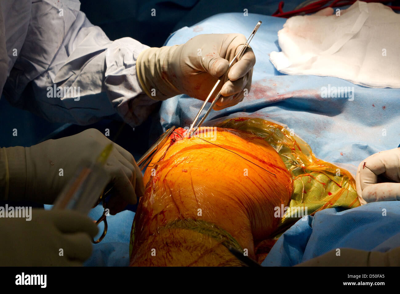Funzionamento dell'ospedale chirurgia ammissione NHS Medico Chirurgo ammissione Foto Stock