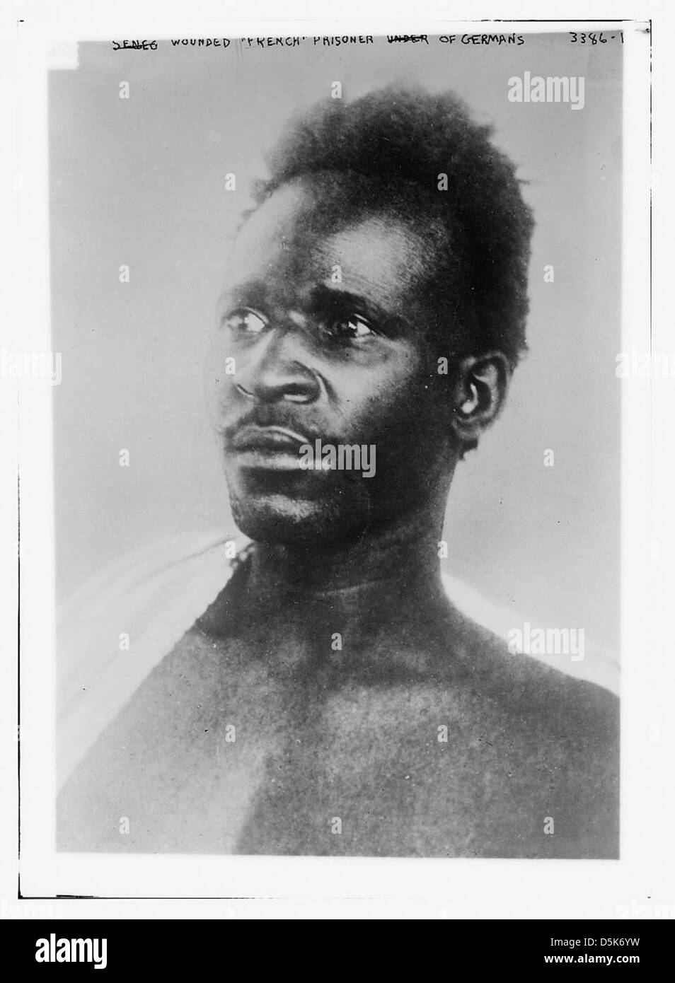 Questa immagine raffigura un prigioniero di guerra francese ferito, probabilmente di origine senegalese, durante la prima guerra mondiale, che mostra le dure realtà delle condizioni di guerra. Foto Stock