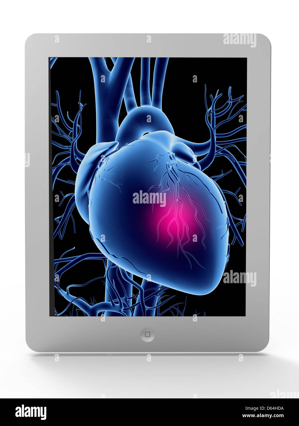 Tablet PC, attacco cardiaco artwork Foto Stock