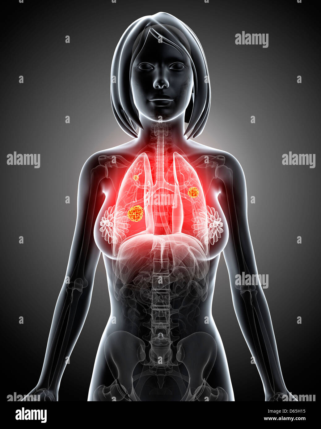 Polmoni femmina, artwork Foto Stock