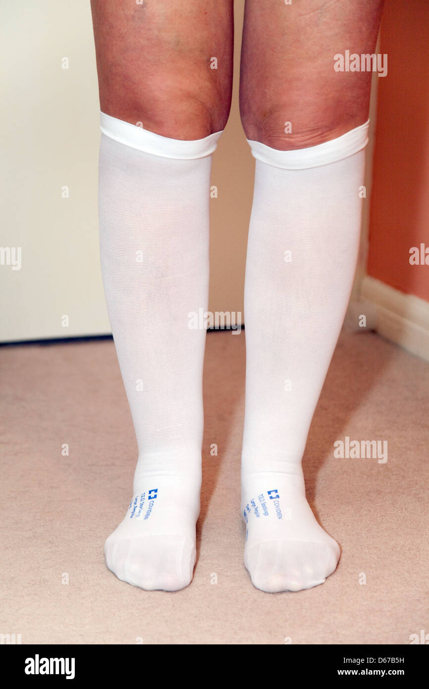 Donna che indossa al di sotto del ginocchio lunghezza TED DVT ( trombosi venosa profonda ) coagulo calze di prevenzione, REGNO UNITO Foto Stock