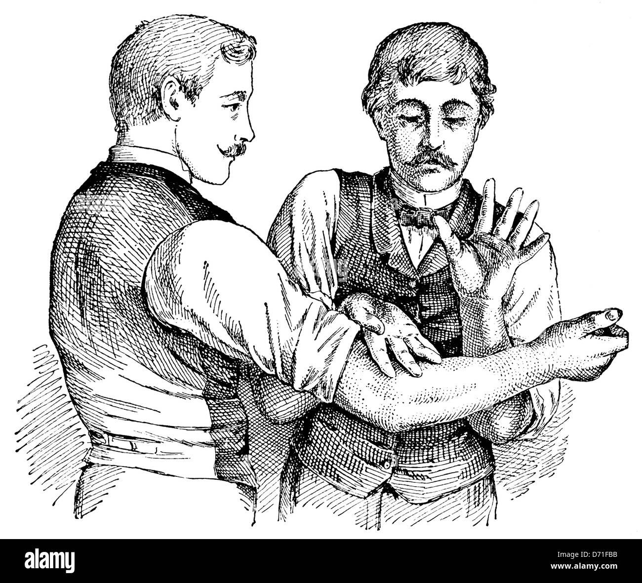 Tapotement tecnica di massaggio, tecniche terapeutiche nei primi del novecento, illustrazione Foto Stock