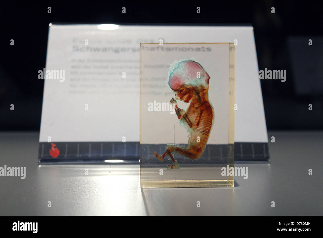 Berlino, Germania, Plastinationen un feto in corrispondenza del corpo mondi mostra di Gunther von Hagens Foto Stock
