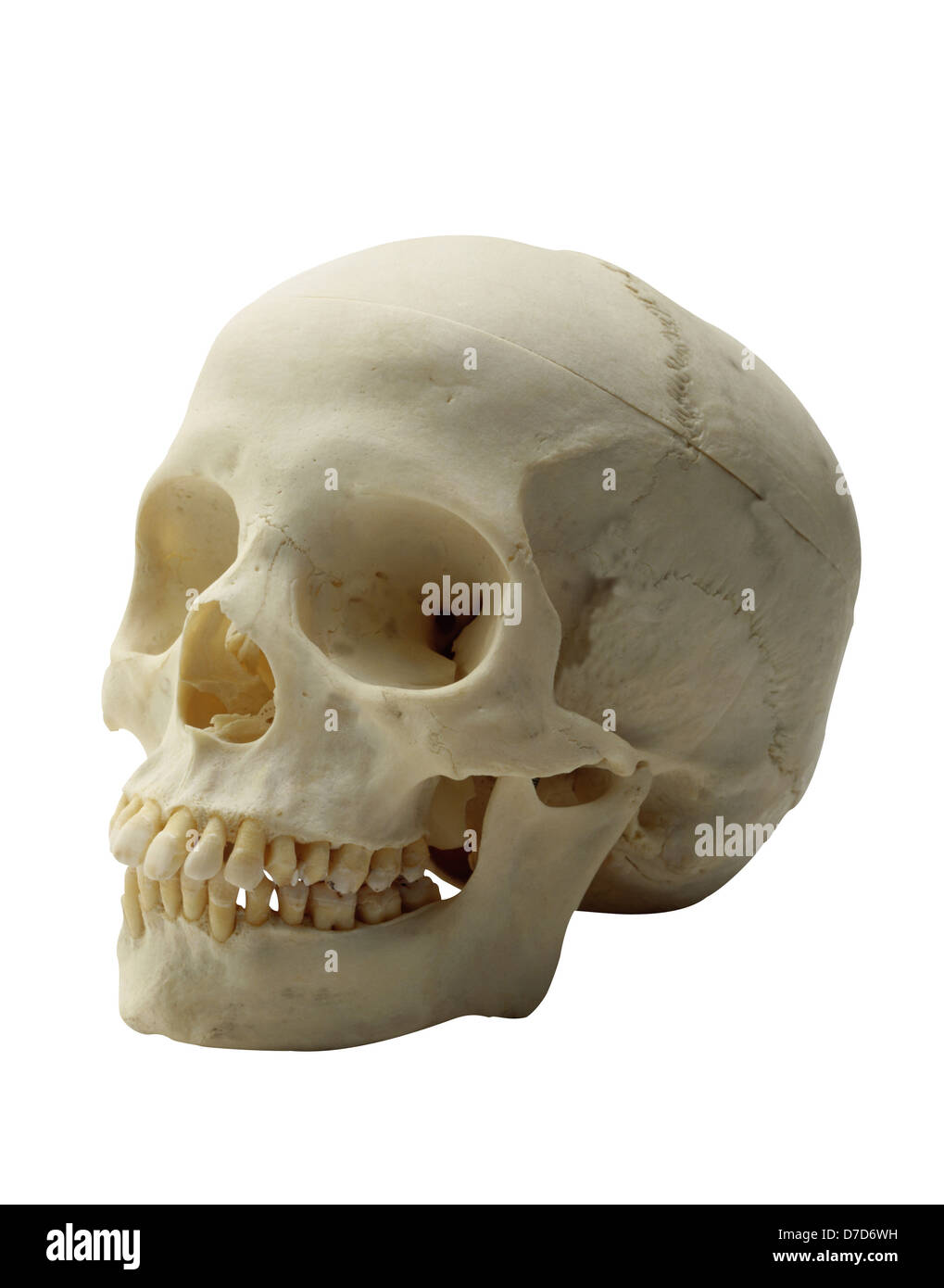 Cranio umano con denti su bianco. Foto Stock