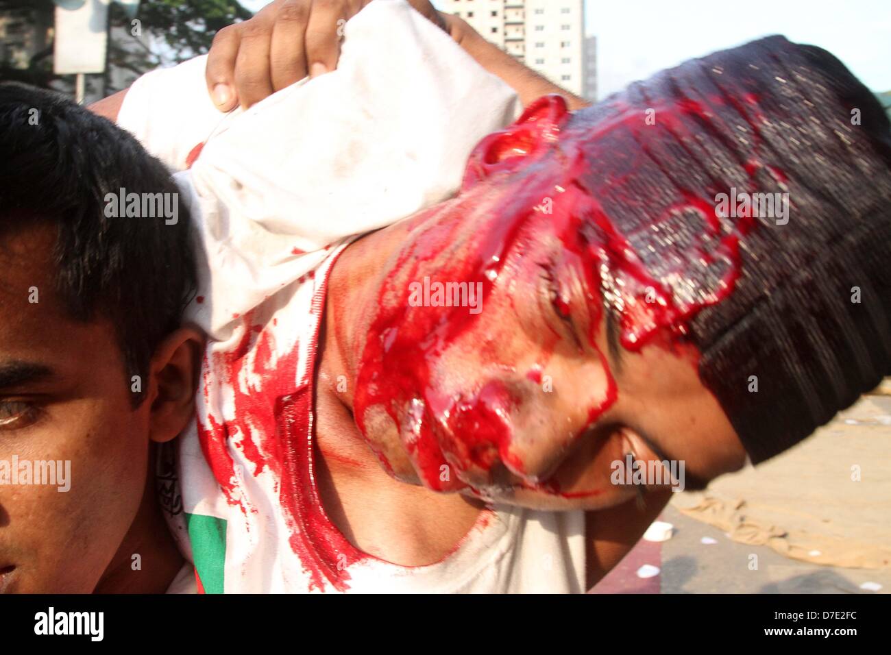 Dacca in Bangladesh. Il 5 maggio, 2013. Popolazione civile di trasportare un ferito protestor islamista durante gli scontri con la polizia a Dhaka il 5 Maggio 2013.Migliaia di islamisti portato Dhaka fino a fermarsi sul 05 maggio come hanno chiesto una legge sulla blasfemia che porta la pena di morte e i funzionari di detto un operaio è stato ucciso in scontri tra dimostranti e polizia. I sostenitori del radicale Hefazat-e-Islam gruppo portato bastoni e bloccato i più importanti punti di ingresso alla città Foto Stock