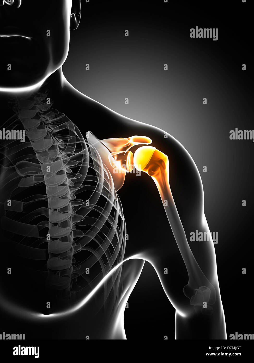 Dolore alla spalla, opere d'arte concettuale Foto Stock