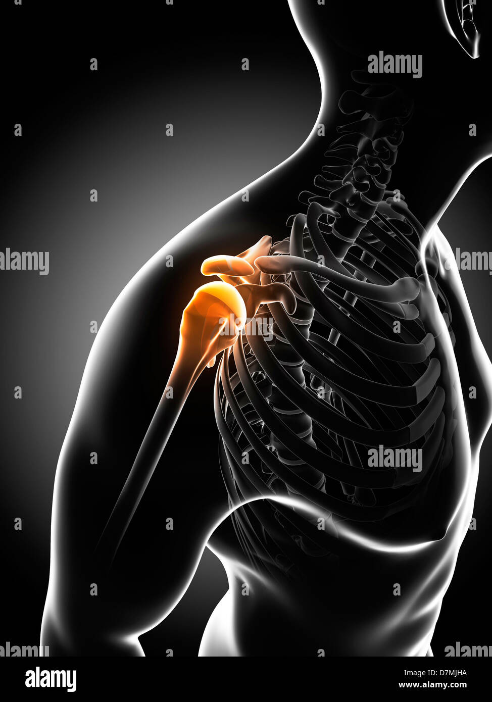 Dolore alla spalla, opere d'arte concettuale Foto Stock