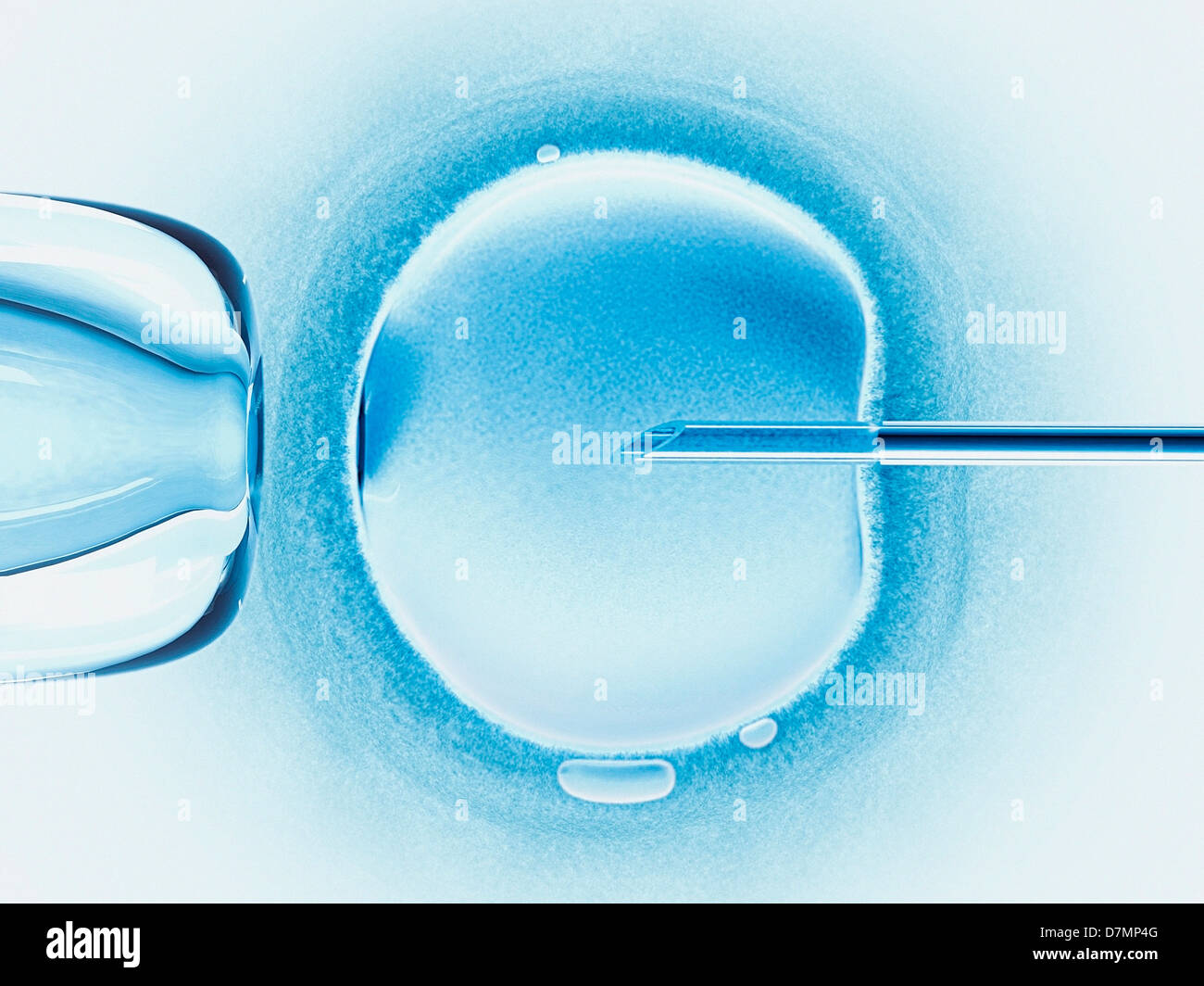 La fertilizzazione in vitro, artwork Foto Stock